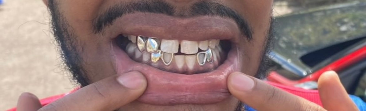 WINDOW GRILLZ