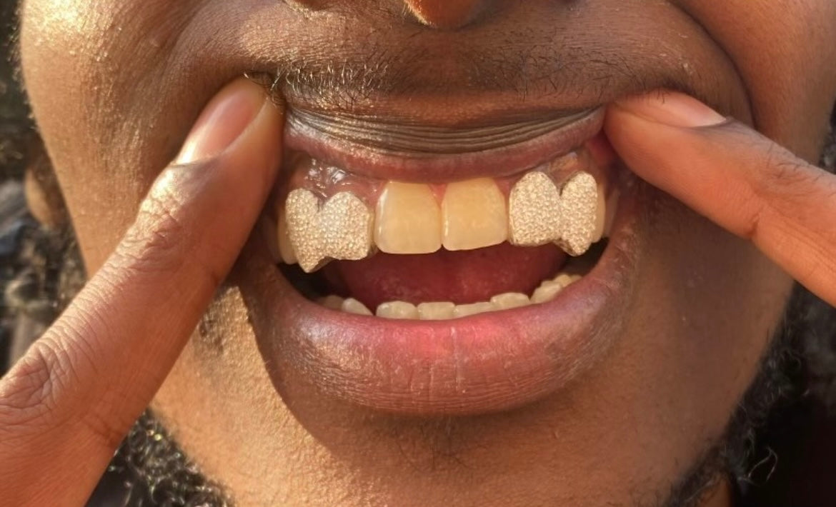 DIAMOND GRILLZ